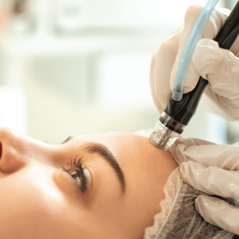 hydradermabrasion